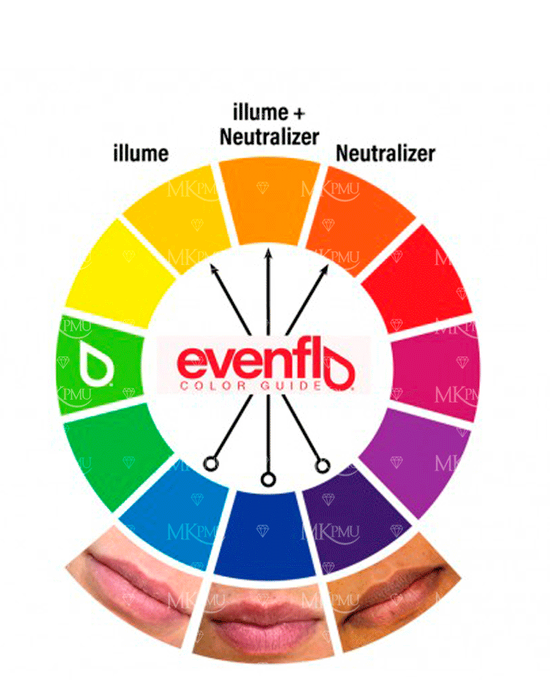 Correctores Evenflo - MKPMU
