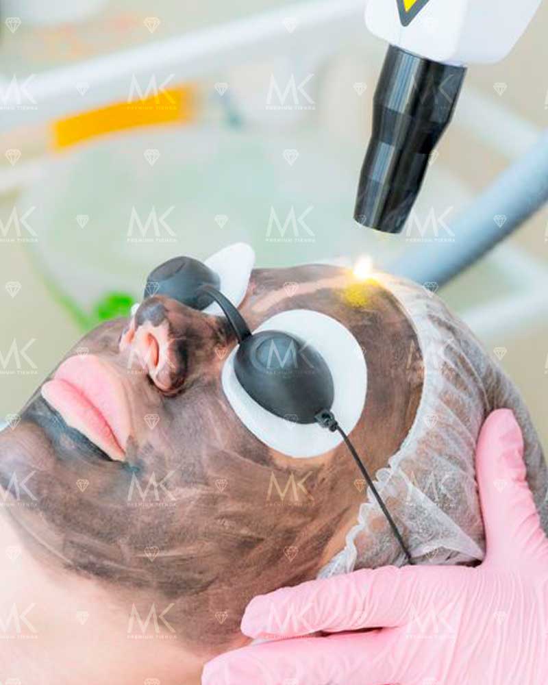 LASER Q Switched ND YAG - MKPMU